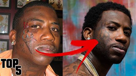 gucci mane before after